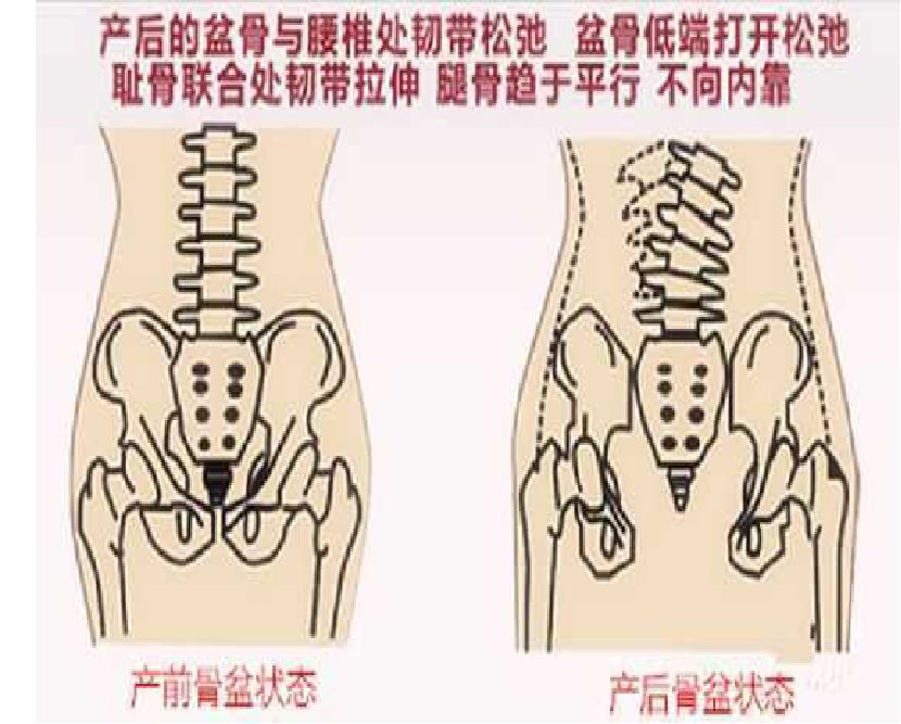 美容項目的另一桶金--產(chǎn)后康復(fù)師