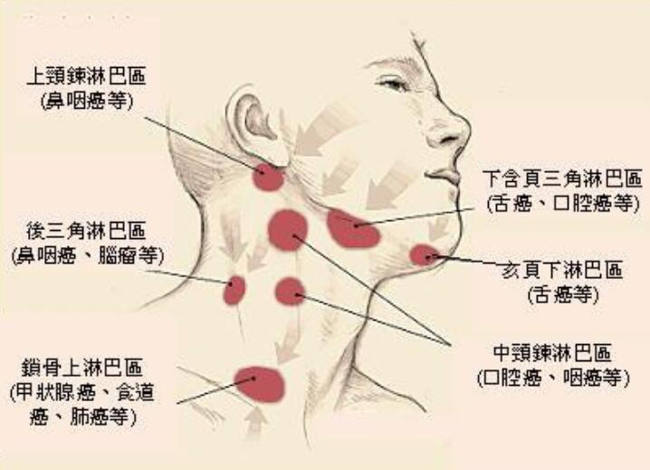 南寧技術(shù)好的美容學(xué)校：刮頸部淋巴的好處