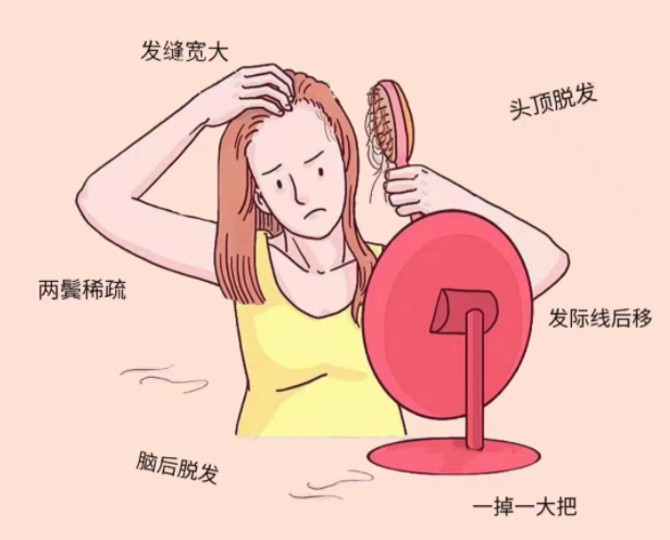 如何緩解脫發(fā)？廣西頭療養(yǎng)生培訓(xùn)學(xué)校分享